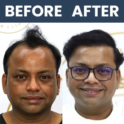 01 Hair Result_22_June_24