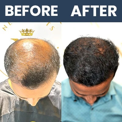 Hair Result Sep_02